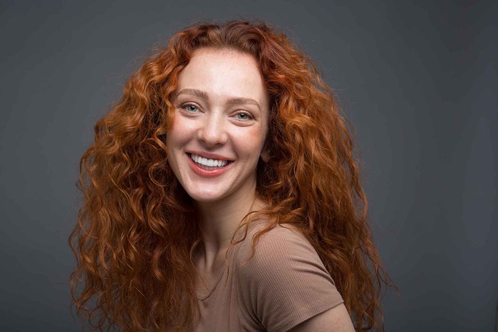 smile makeover in Dubai - celebrity smile makeovers