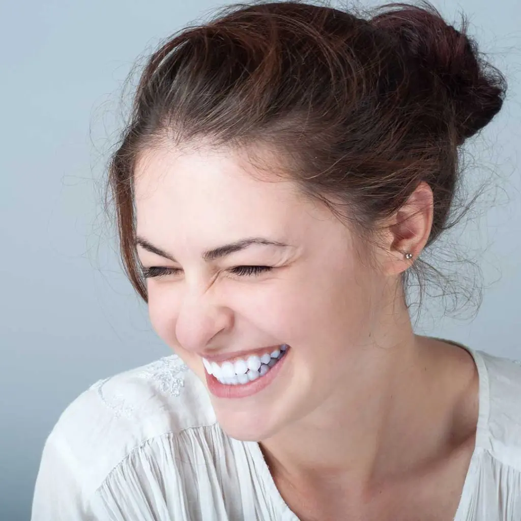 Full Mouth Rehabilitation in Dubai 24 smile makeover in Dubai