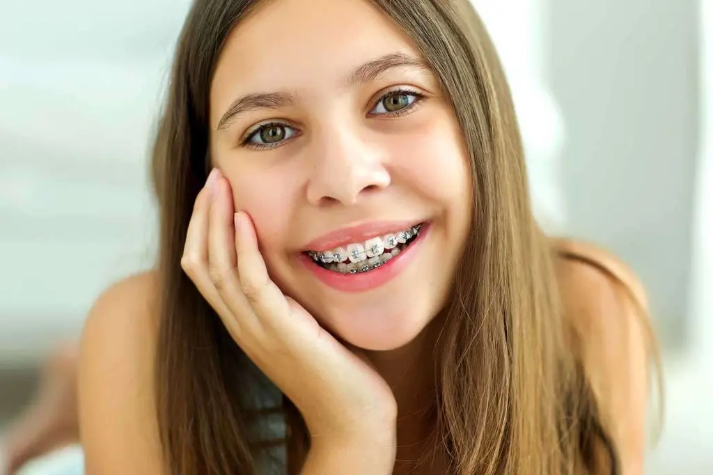 Orthodontist in Dubai - What Is Interceptive Orthodontics