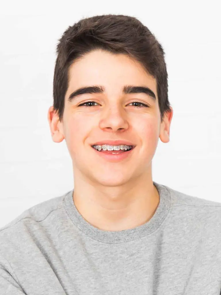 damon braces in dubai
