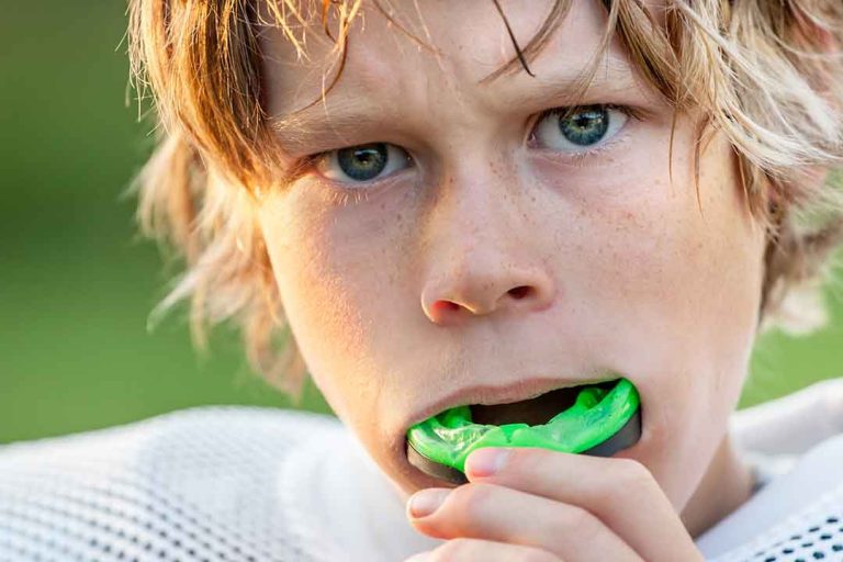 sports mouthguard in Dubai - can I wear a mouthguard with braces