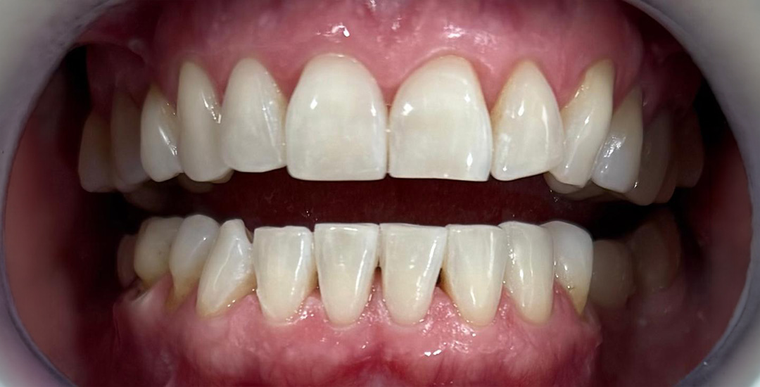 Charlotte Oliver - After