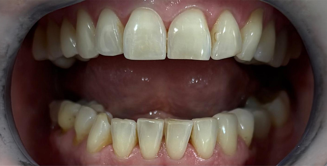 Charlotte Oliver - Before