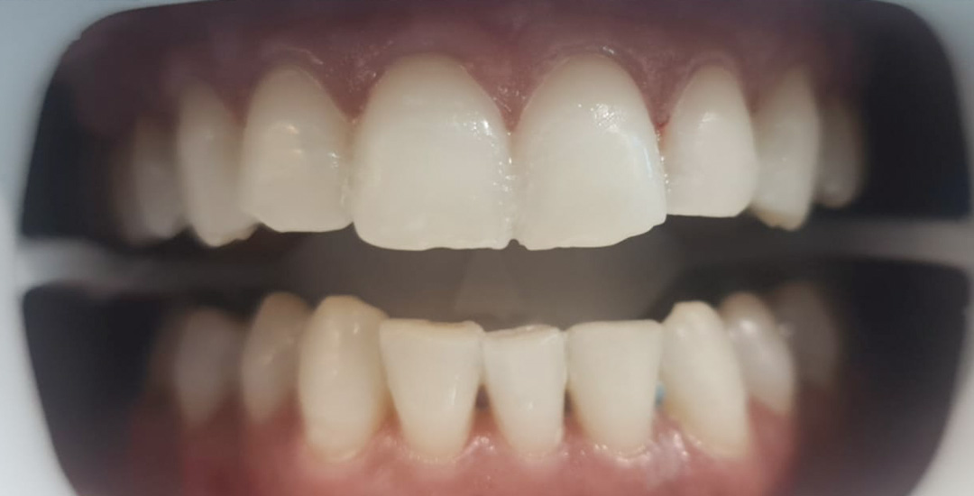 Hilary Sherice Browne – After