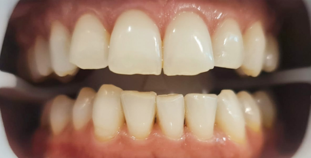 Hilary Sherice Browne – Before