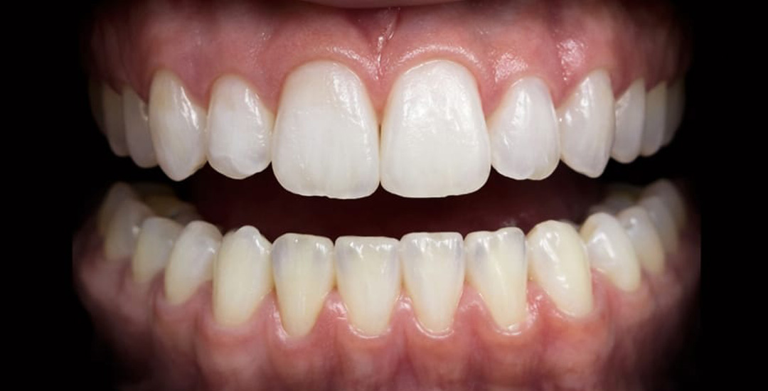 Megan Murray - After