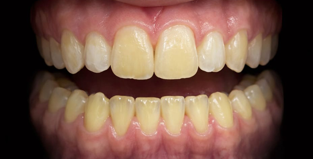 Megan Murray- Before