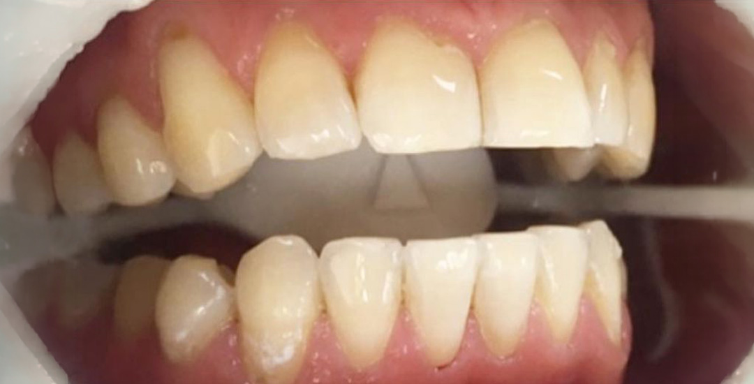 Felicia Bjurfjäll - After