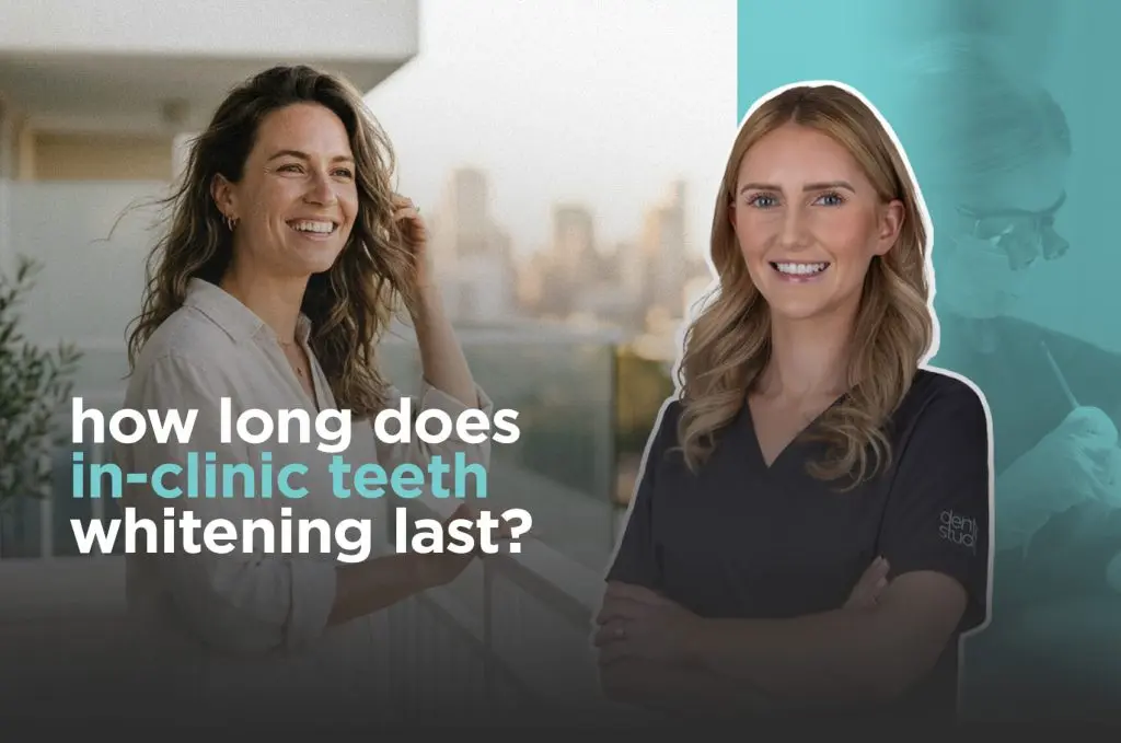 how-long-does-in-clinic-teeth-whitening-last