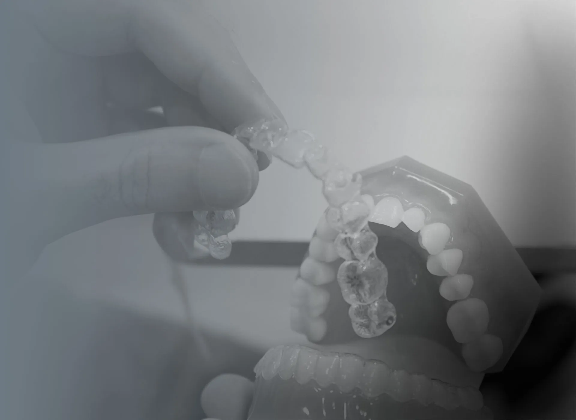 Clear Aligners in Dubai