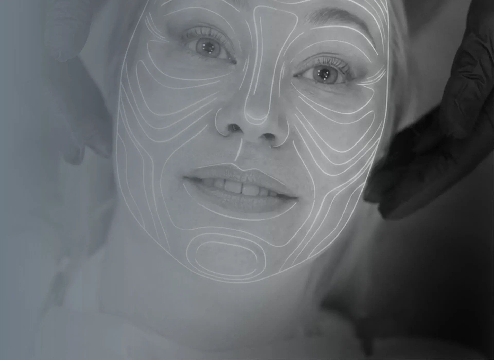 Full mouth rehabilitation in Dubai - smile makeover in Dubai