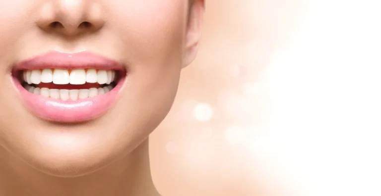 do composite veneers stain