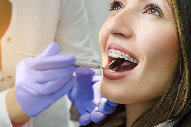 how to brush teeth with braces