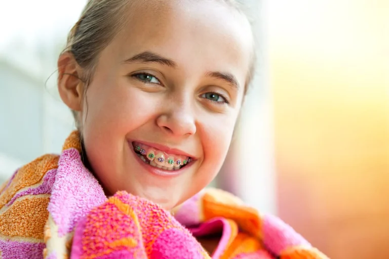 how long do braces take to straighten teeth