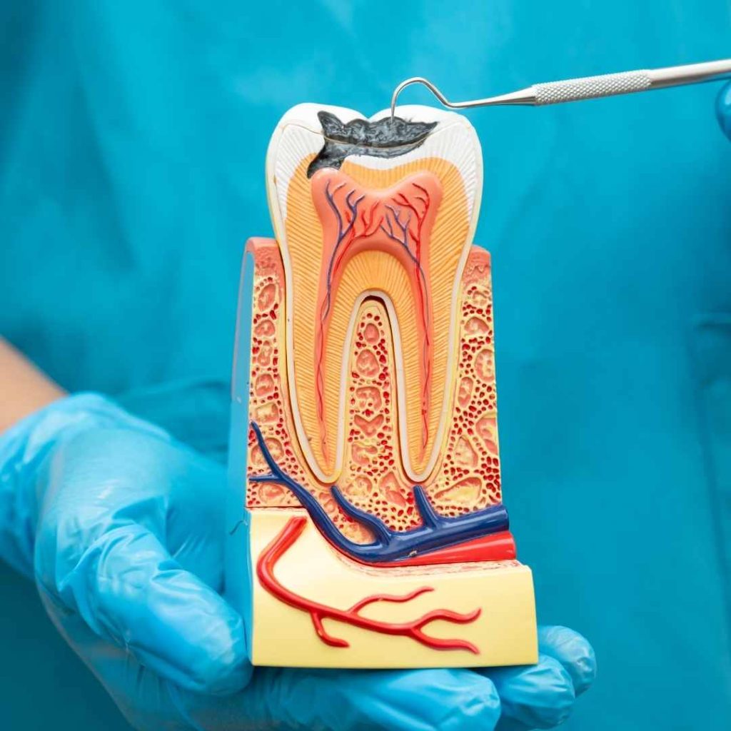 Root Canal Treatment 12 Progetto senza titolo 1