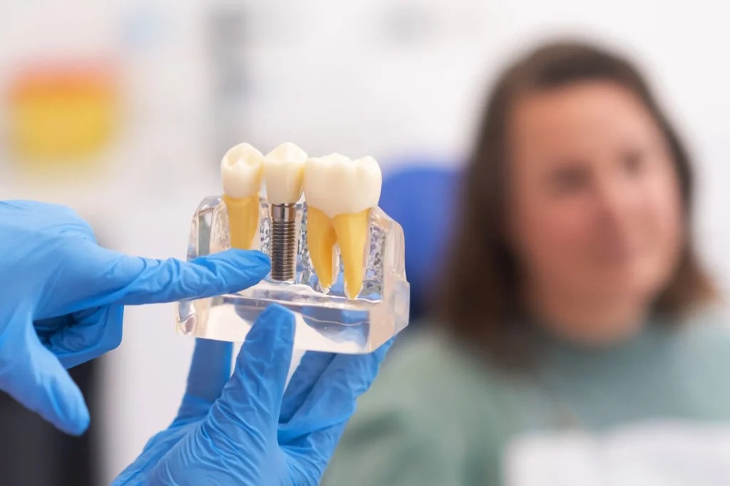 Dental implants in Dubai